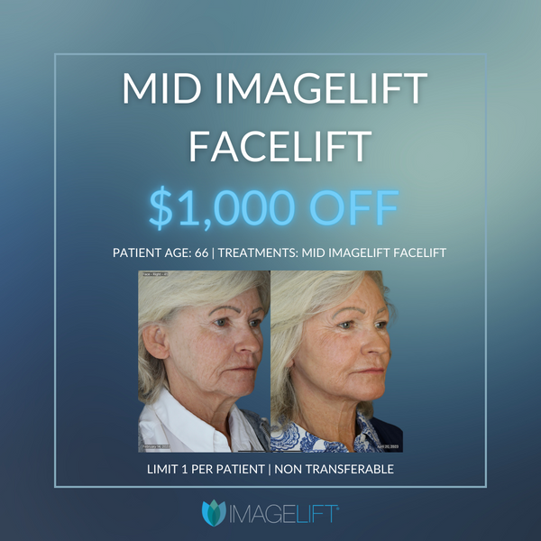 $1000 Off A Mid-ImageLift