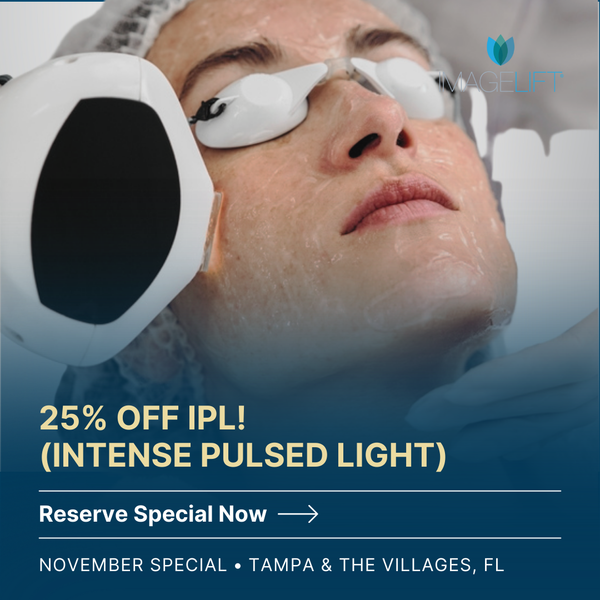 25% OFF IPL (Intense Pulsed Light)