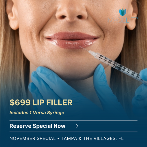 $699 Versa Lip Filler